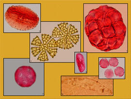 
Chaîne d'observations microscopiques : un outil pour la recherche. Images numériques. Palynologi...